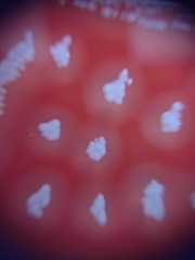 Staphylococcus aureus