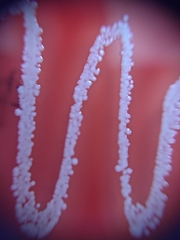 Staphylococcus aureus