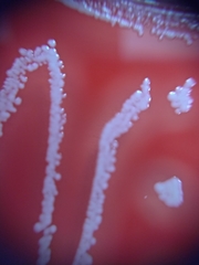 Staphylococcus aureus