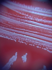 Staphylococcus aureus