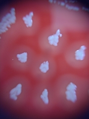 Staphylococcus aureus