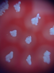 Staphylococcus aureus