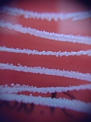 Staphylococcus aureus