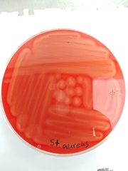 Staphylococcus aureus