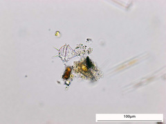 Protoperidinium