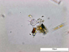 Protoperidinium