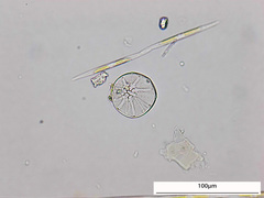 Asteromphalus