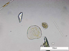 Asteromphalus
