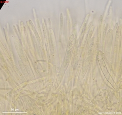 Lachnellula calyciformis