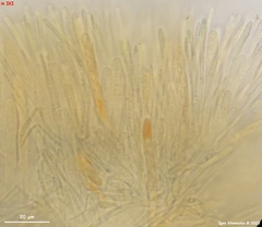 Lachnellula calyciformis