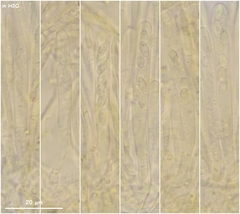 Lachnellula calyciformis
