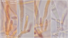 Lachnellula calyciformis