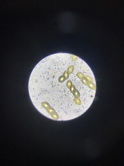 Hydnotrya variiformis