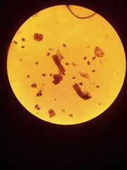 Diplazium ternatum