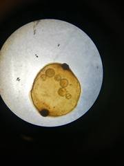 Erpobdellidae