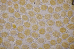 Melampsora aecidioides