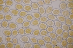 Melampsora aecidioides