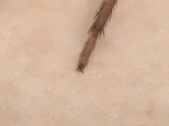 Gnaphosidae