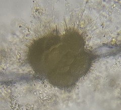 Globigerina