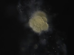 Globigerina