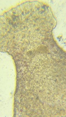 Macrostomum