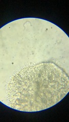 Macrostomum