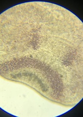 Macrostomum