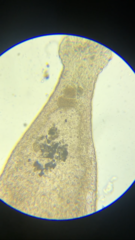 Macrostomum