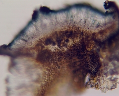 Lecidella carpathica