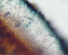 Lecidella carpathica