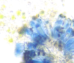 Lecidella carpathica