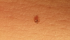 Amblyomma cajennense