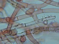 Botryobasidium conspersum