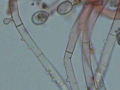 Botryobasidium conspersum