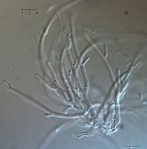 Paprastasis Raudonspuogis nuotrauka