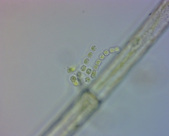 Neonema