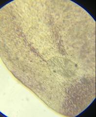 Macrostomum