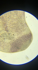 Macrostomum