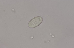 Morchella norvegiensis