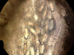 Pertusaria paratuberculifera