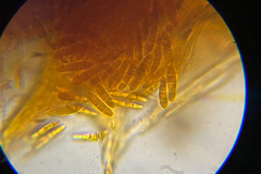 Arachnopeziza aurelia