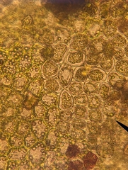 Crossocalyx hellerianus