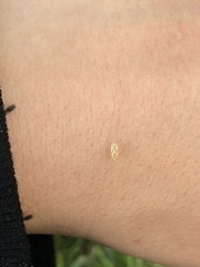 Thaumastocoris peregrinus