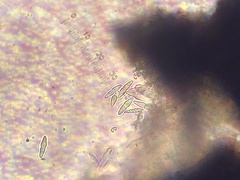 Glonium stellatum