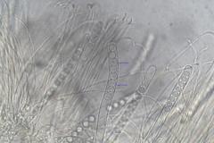 Pulvinula archeri