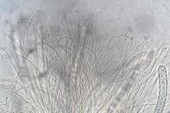 Pulvinula archeri