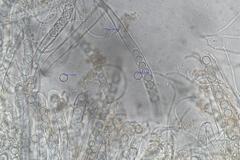 Pulvinula archeri