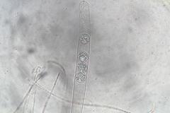 Pulvinula tetraspora