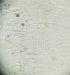 Trichaleurina tenuispora