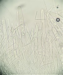Trichaleurina tenuispora